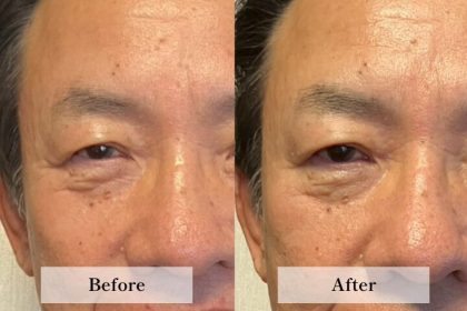 60代 A.K.様