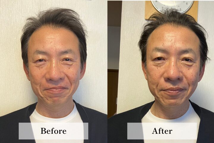 60代 A.K.様